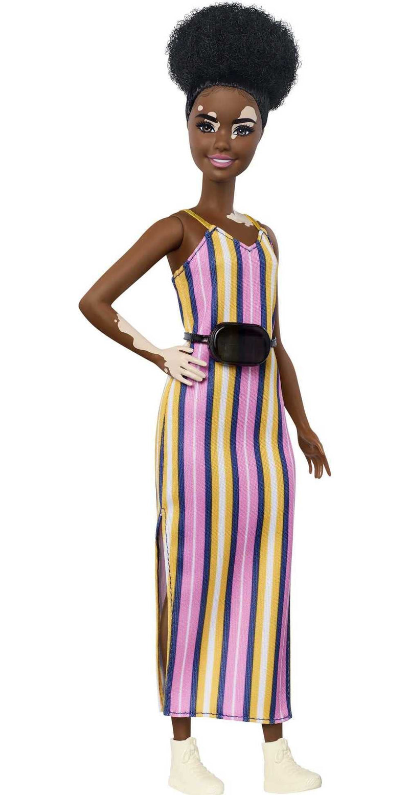 Barbie Fashionistas Doll #135 with Vitiligo and Curly Brunette Hair Wearing Striped Dress and Accessories