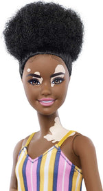 Barbie Fashionistas Doll #135 with Vitiligo and Curly Brunette Hair Wearing Striped Dress and Accessories